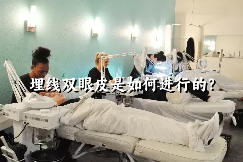 埋线双眼皮是如何进行的？