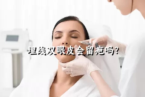 埋线双眼皮会留疤吗？