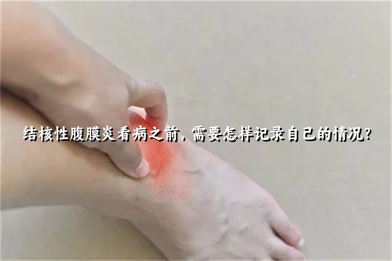 结核性腹膜炎看病之前，需要怎样记录自己的情况？