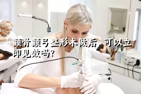 颧骨颧弓整形术做后，可以立即见效吗？