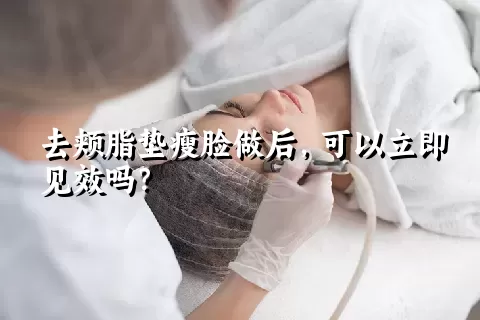 去颊脂垫瘦脸做后，可以立即见效吗？