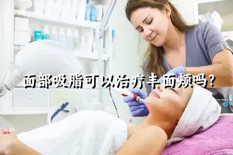 面部吸脂可以治疗丰面颊吗？