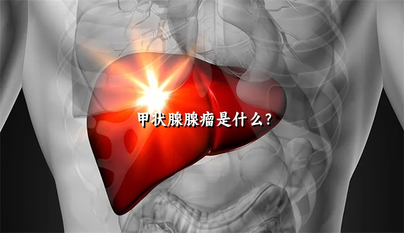 甲状腺腺瘤是什么？