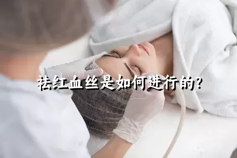 祛红血丝是如何进行的？