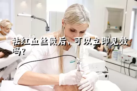 祛红血丝做后，可以立即见效吗？