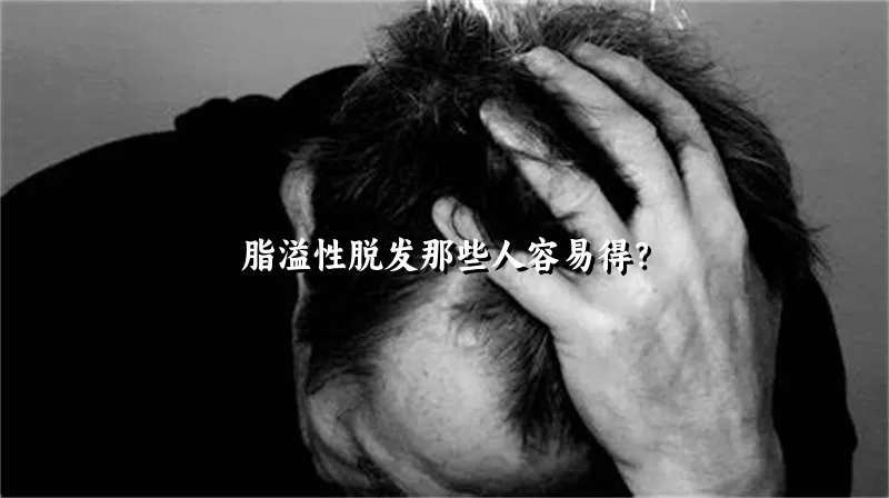 脂溢性脱发那些人容易得？