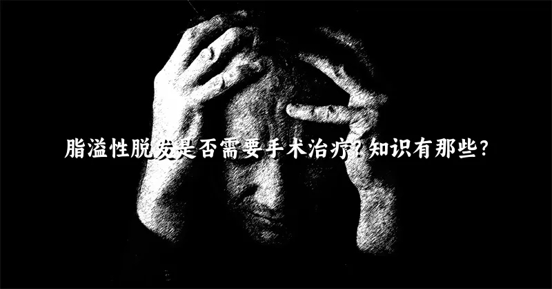 脂溢性脱发是否需要手术治疗？知识有那些？