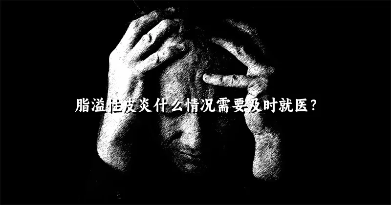 脂溢性皮炎什么情况需要及时就医？