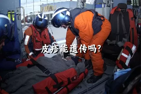 皮疹能遗传吗?