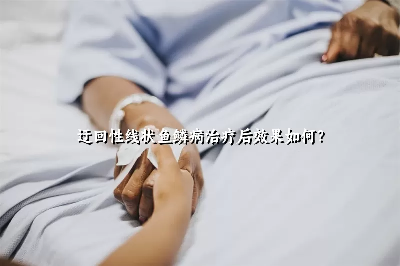 迂回性线状鱼鳞病治疗后效果如何？