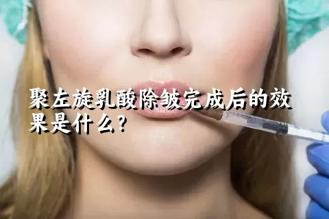 聚左旋乳酸除皱完成后的效果是什么？