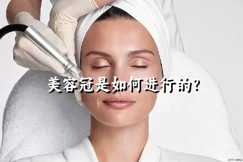 美容冠是如何进行的？