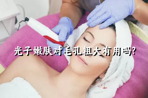 光子嫩肤对毛孔粗大有用吗?